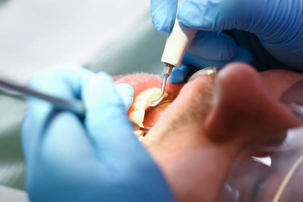 Best Emergency Treatment for Toothache in Almont, MI
